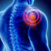 donuk-omuz-frozen-shoulder
