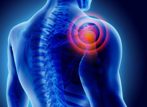 donuk-omuz-frozen-shoulder