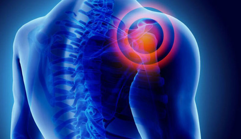 donuk-omuz-frozen-shoulder