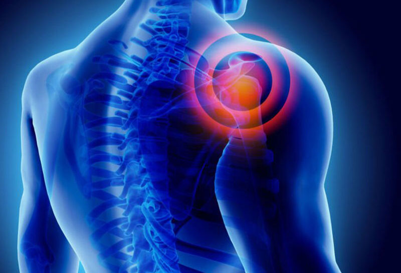donuk-omuz-frozen-shoulder donuk-omuz-frozen-shoulder