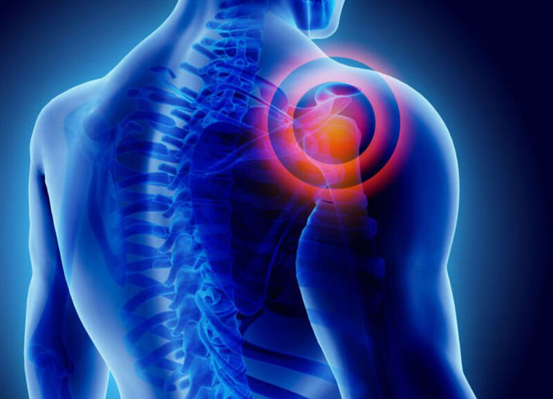 donuk-omuz-frozen-shoulder