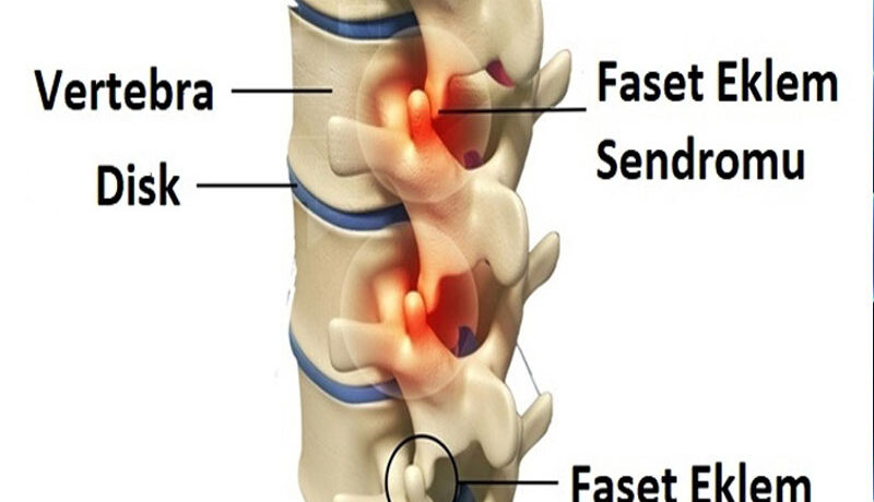 faset