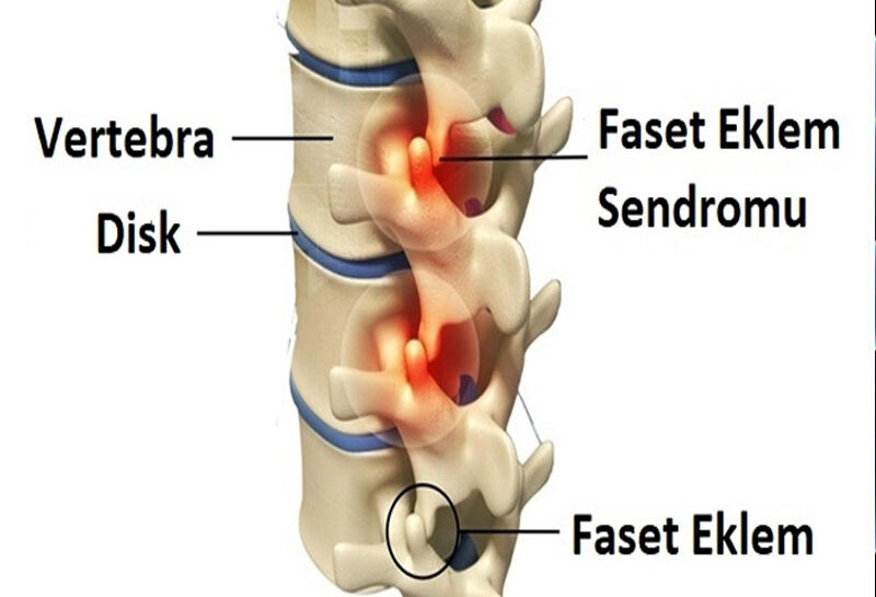 faset faset